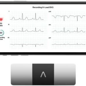 KardiaMobile 6-Lead Personal EKG Monitor – Six Views of The Heart – Detects AFib and Irregular Arrhythmias – Instant Results in 30 Seconds – Works with Most Smartphones - FSA/HSA Eligible